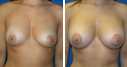 Before & After Photos